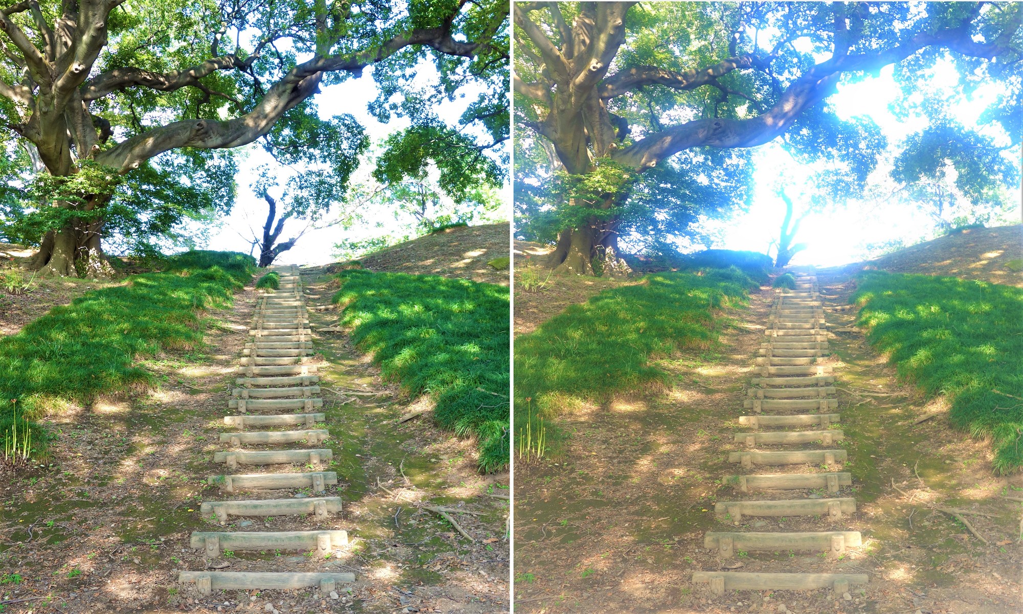 視界が眩しい（羞明）という症状について