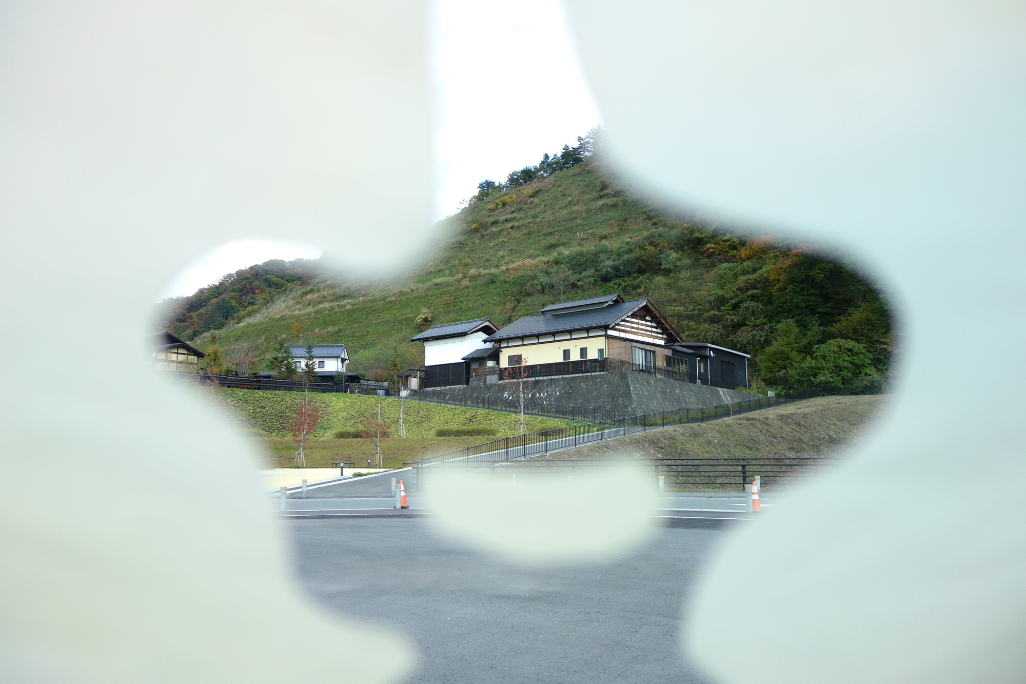 視界・視野が欠ける症状について